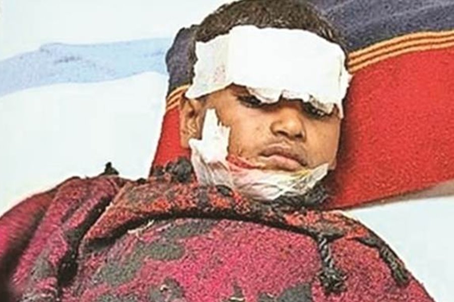 आवारा कुत्तो के झूंड से भिड़ गई मां... मौत के मुंह से बेटे को खींच लाई बाहर... बुरी तरह लहूलुहान हो गया मासूम