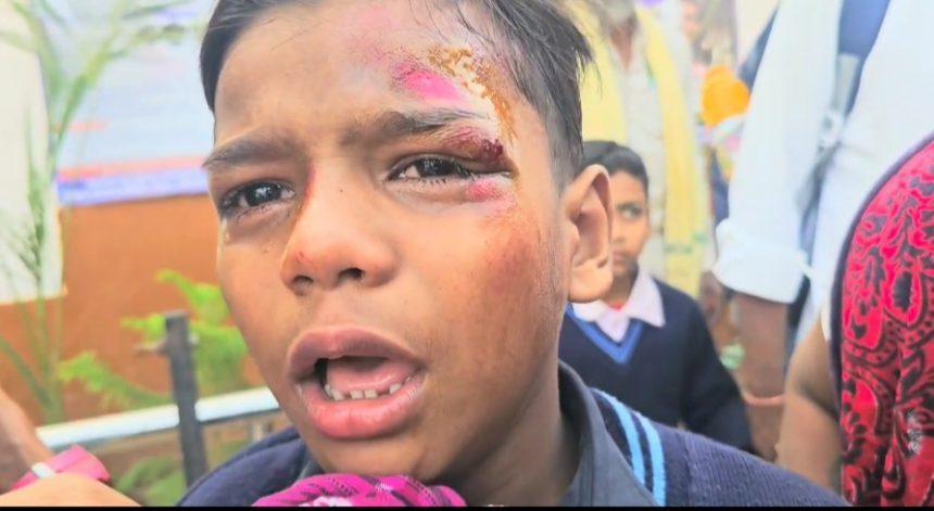 एसडीएम की गाड़ी से बच्चे को लगी ठोकर,. नशे में था चालक... गाड़ी में एसडीएम थे मौजूद