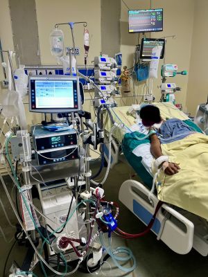 एम्स रायपुर ने छत्तीसगढ़ में किया पहला सफल वीए-ईसीएमओ केस