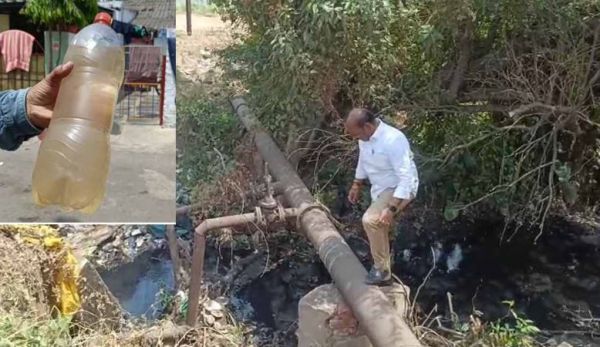 भिलाई के सेक्टर-7 में पीलिया का कहर : दो दिनों से नलों में आ रहा गंदा पानी, 35 से ज्यादा बच्चे बीमार