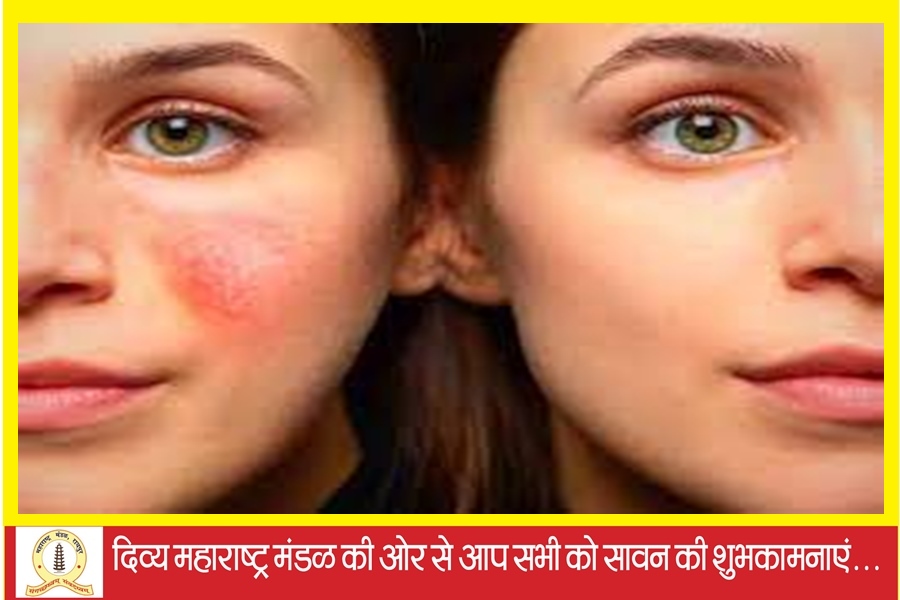 बारिश में चेहरे की चमक बरकरार रखना चाहता है तो बारिश में यह खाने से बचे