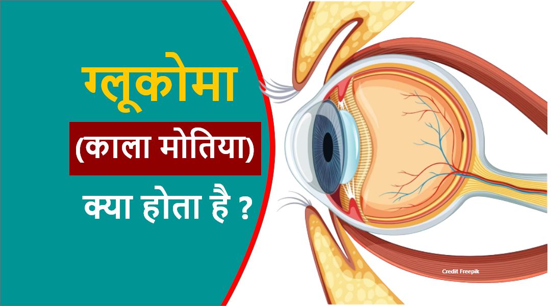 Health : सतर्क रहिये, ग्लूकोमा के लक्षण शुरुआती अवस्था में नजर नहीं आते.