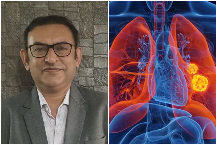  स्वस्थ आहार, योग और नियमित जांच कैंसर से जंग में होगी सहायक