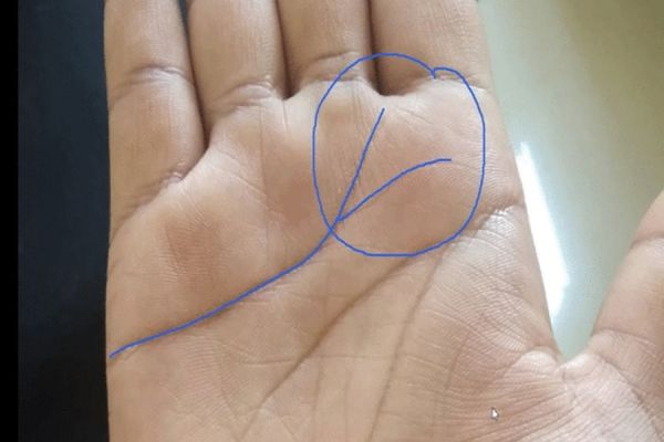 क्या आपकी भी हथेली में है V का निशान... हस्तरेखा शास्त्र में बेहद खास है यह... जानिए पूरी बात
