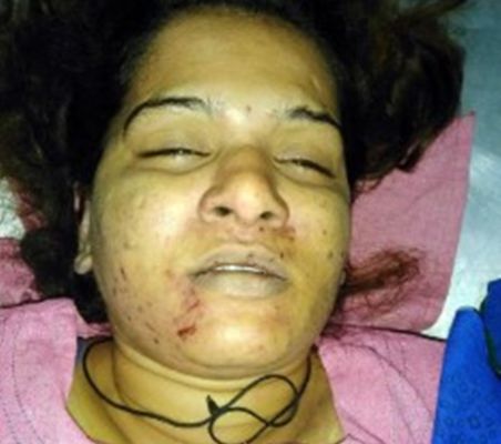 BIG NEWS : मशहूर मराठी अभिनेत्री की बहन की मौत... संदिग्ध हालत में मिली लाश... चेहरे पर चोट के निशान