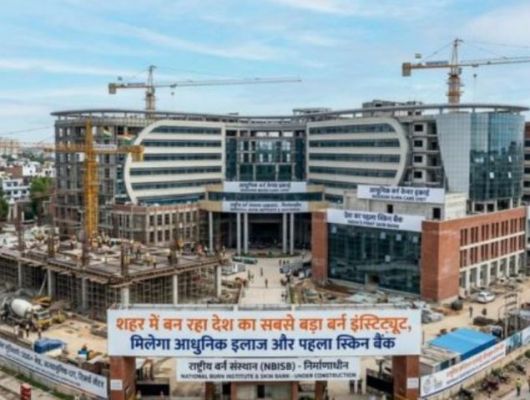 वाराणसी से उठी उम्मीद की नई लौ: बर्न इंस्टिट्यूट बनेगा जीवन बचाने का सबसे बड़ा केंद्र