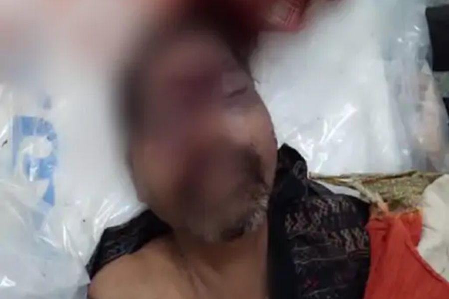 RAIPUR CRIME : राजधानी में दिव्यांग की हत्या... कमल विहार के पास मिली लाश... चार दिनों में दूसरी वारदात
