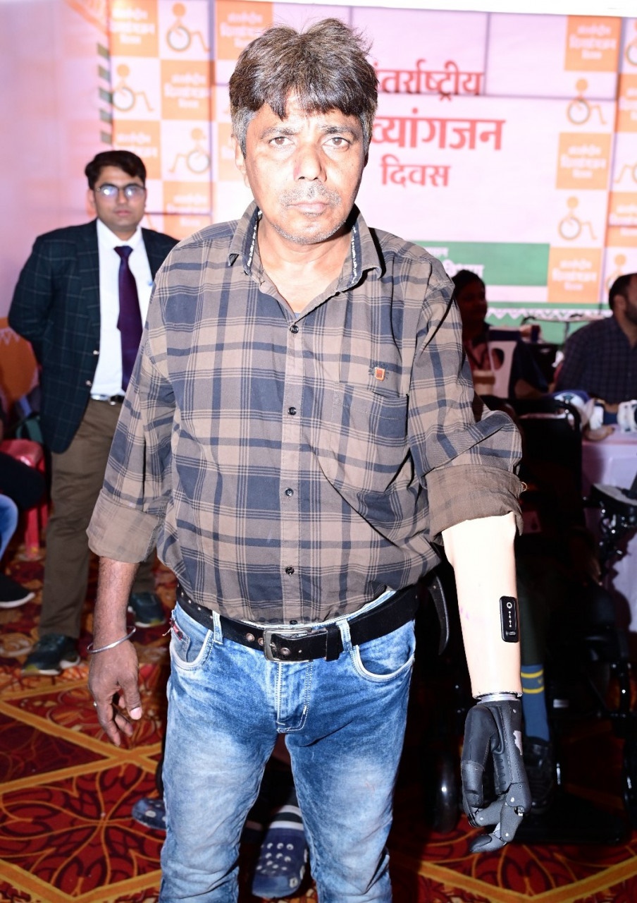 मोहन को जब मिला निःशुल्क कृत्रिम फंक्शनबेल हाथ : बोले अब सब कार्य स्वंय कर सकूंगा
