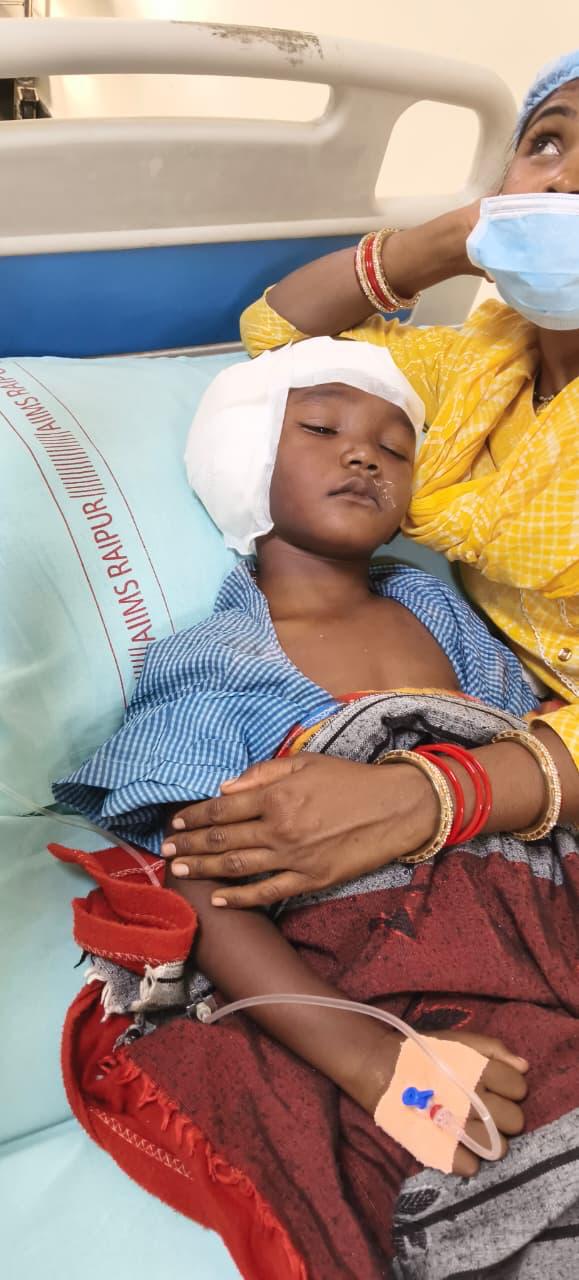 चिरायु का असर: जन्मजात बधिरता से जूझ रहे तीन बच्चों का एम्स रायपुर में सफल कॉक्लियर इंप्लांट