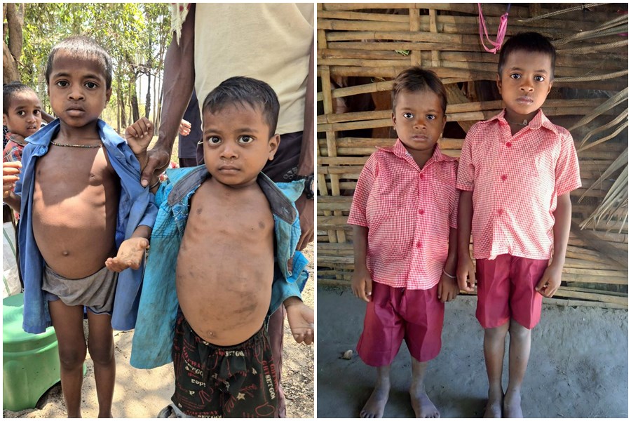 घने जंगलों और नदी-नालों को पार कर स्वास्थ्य दूतों ने बचाई दो मासूमों की जान