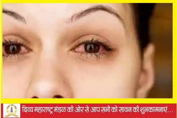  छत्तीसगढ़ में तेजी से फैल रहा आई फ्लू..... बिलासपुर शहर में बेकाबू हुए मामले